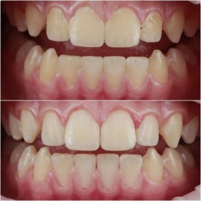 ����������� ������: ��� ������ ������ ����� ������ ��� ��������