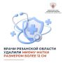 Врачи Рязанской области удалили миому матки размером более 12 см